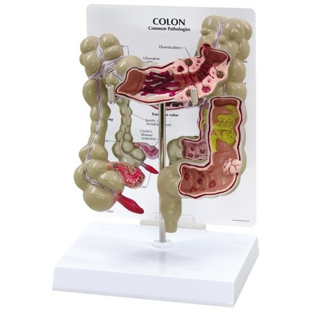 GPI ANATOMICAL Anatomical Model - Colon 3340